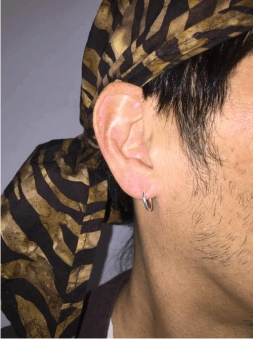 Pirate Ear Ring - Image 2
